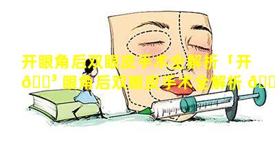 开眼角后双眼皮手术全解析「开 🌳 眼角后双眼皮手术全解析 🐵 多少钱」